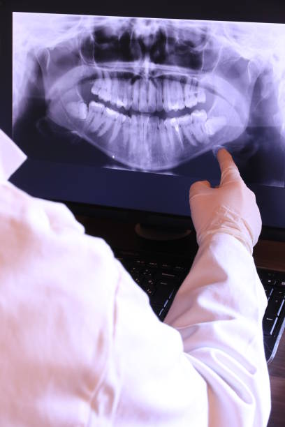 Best Emergency Gum Treatment in St Louis, MO