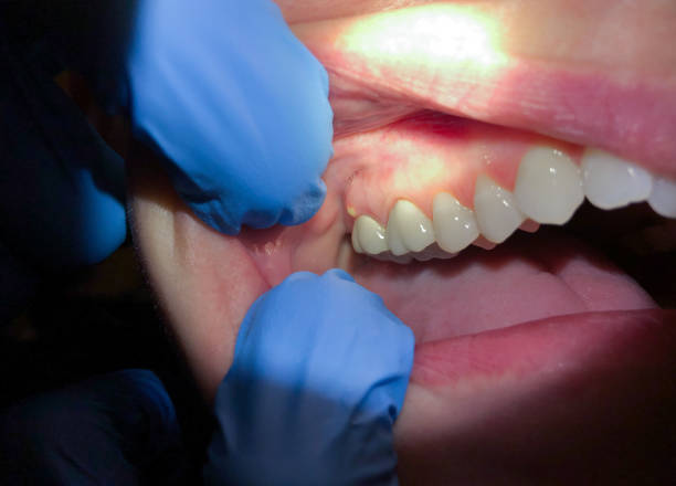 Best Weekend Emergency Dentist in St Louis, MO
