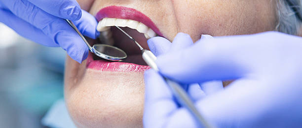 Best Emergency Denture Repair in St Louis, MO